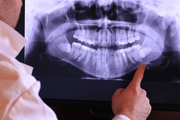 Best Emergency Treatment for Toothache in Fordoche, LA